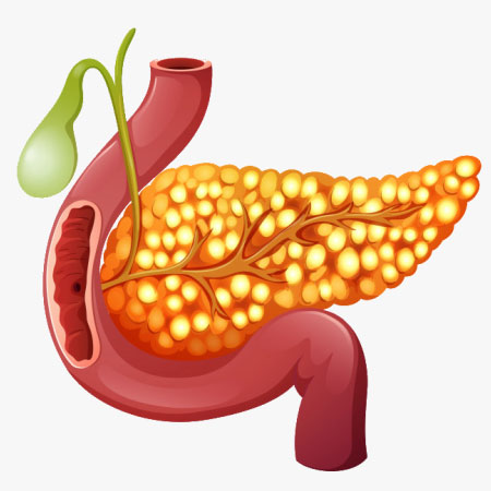Chronic pancreatitis treatment in Hyderabad