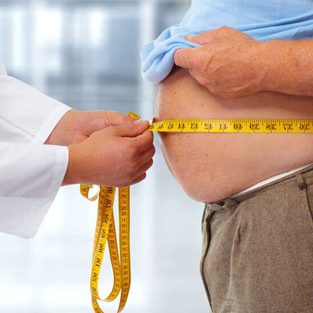 Bariatric Surgeries