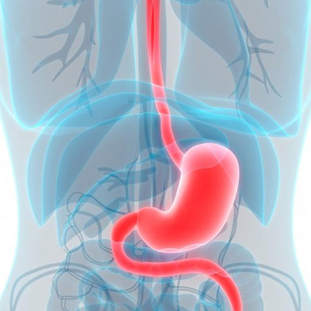 Esophagus Problem